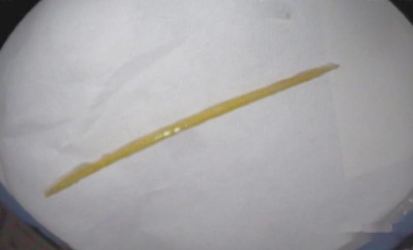 13岁少年的口腔空间与牙签的极限挑战-第2张图片