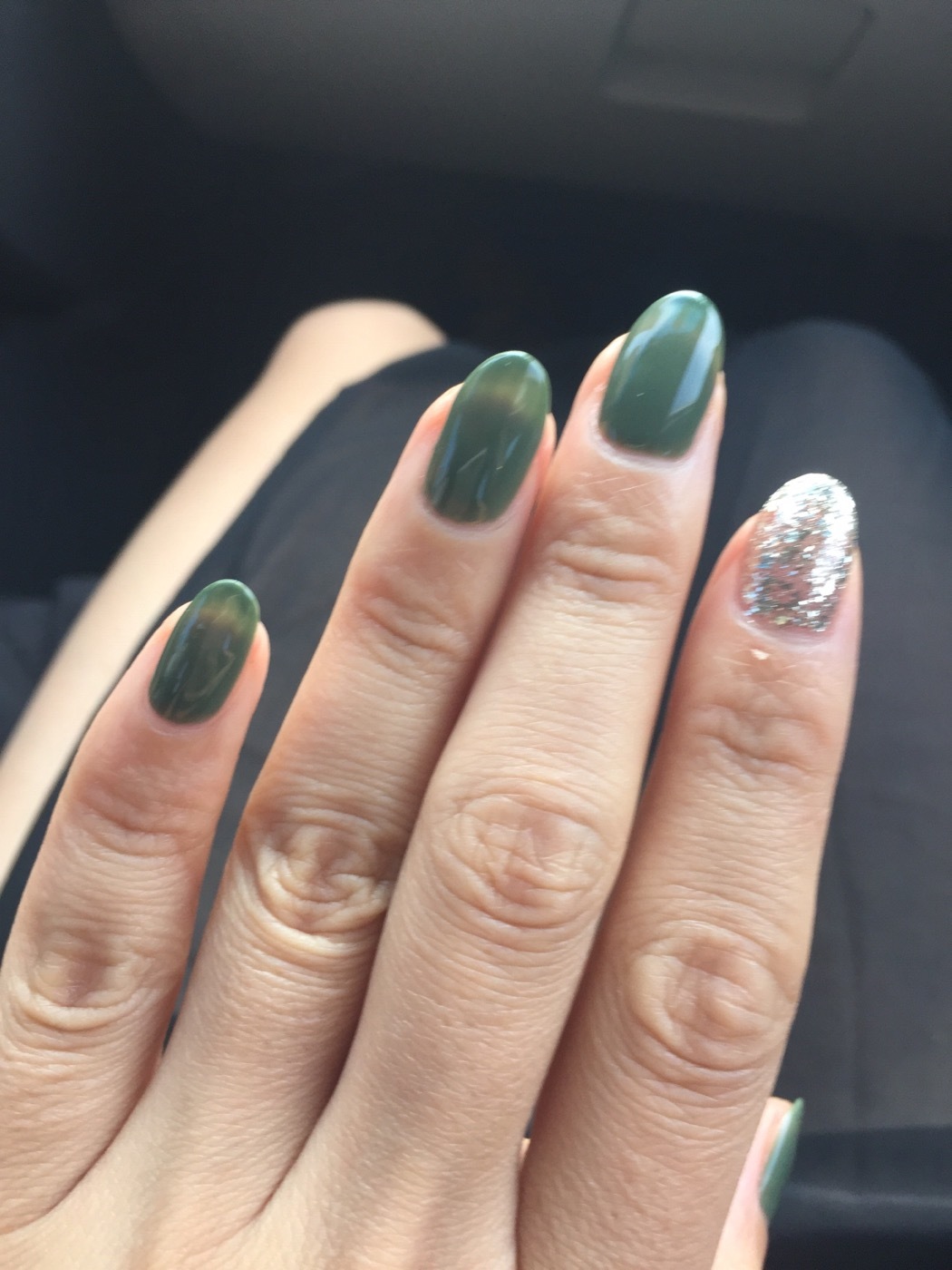 女性三角毛毛区腹部里面疼痛5252女性三角毛毛区腹部疼痛，原因、诊断与治疗-第1张图片